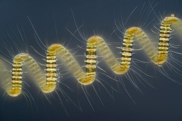 Колониальный организм планктона — Chaetoceros debilis - 30+ Фотографий под Микроскопом