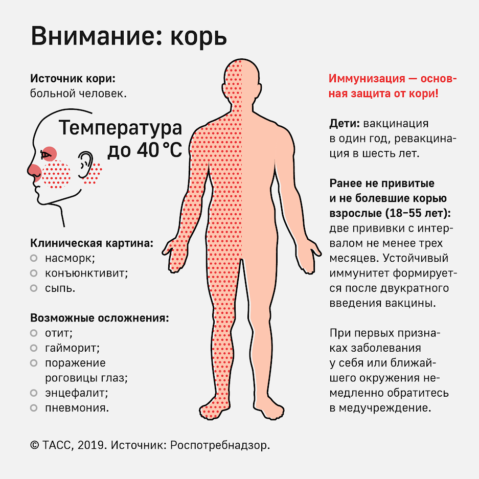 Чим зневіриться вітряна віспа від кору, а скарлатина від краснухи? Корь, скарлатина, краснуха