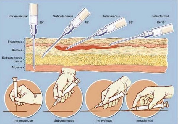 Як робити уколи вдома самостійно Как делать уколы дома