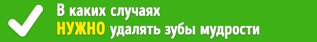 Чи потрібно насправді видаляти зуби мудрості? Удалять или нет зубы мудрости