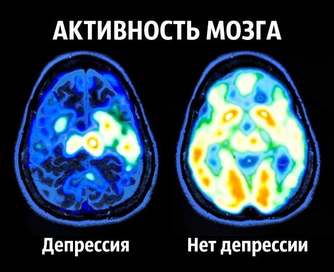 Поради нейробіолога про те, як стати щасливим раз і назавжди Как стать счастливым