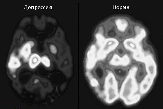 Все, що переживає Душа, Тіло робить видимим Что переживает Душа, Тело делает видимым
