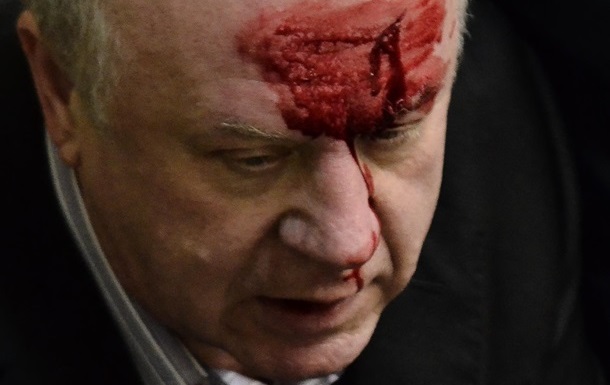 Бывшему шефу безопасности Ахметова разбили лоб в зале Рады