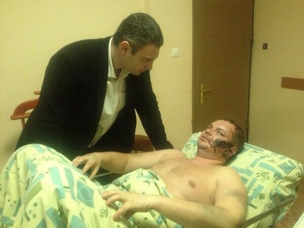 Мене розіп&39;яли, особа порізали, вухо відрізали, на тілі живого місця немає, - Булатов розповів про звірства викрадачів. ВІДЕО Меня распяли, лицо порезали, ухо отрезали, на теле живого места нет, - Булатов рассказал о зверствах похитителей. ВИДЕО