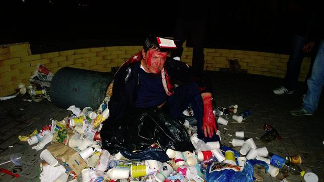 Невідомі не допустили Пилипишина в ЦВК і перекинули його в смітник. ФОТО Неизвестные не допустили Пилипишина в ЦИК и опрокинули его в мусорник. ФОТО