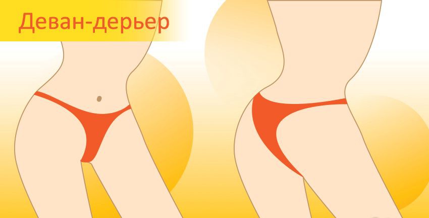Деван-дерьер - Види жіночих трусиків Деван-дерьер - Виды женских трусиков