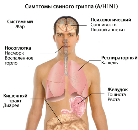 Пам`ятка щодо грипу типу А / Н1N1