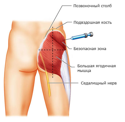 Як робити уколи вдома самостійно Как делать уколы дома самостоятельно