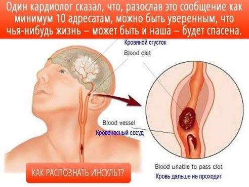 Розпізнавання симптомів інсульту Распознование симптомов инсульта